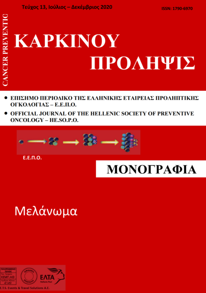 melanoma